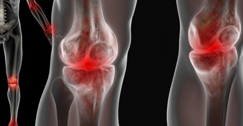 Homeopathy Treatment for Joint Pain Homeopathy Treatment for Joint Pain