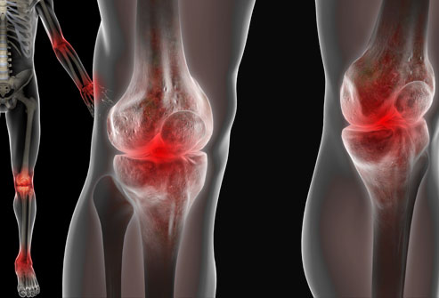 Homeopathy Treatment for Joint Pain 1 Homeopathy Treatment for Joint Pain 1
