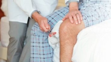 Arthritis, Rheumatism Prevention and Treatment with Naturopathy Cure – 1