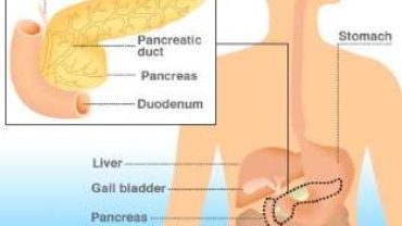 Naturopathy Cure – Diverticulitis, Pancreas Disorder