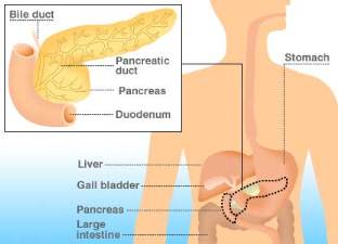 Naturopathy Cure - Diverticulitis, Pancreas Disorder 1
