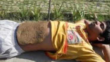 Naturopathy Treatment Methods – Kidney Pack, Abdominal Pack, GH Pack