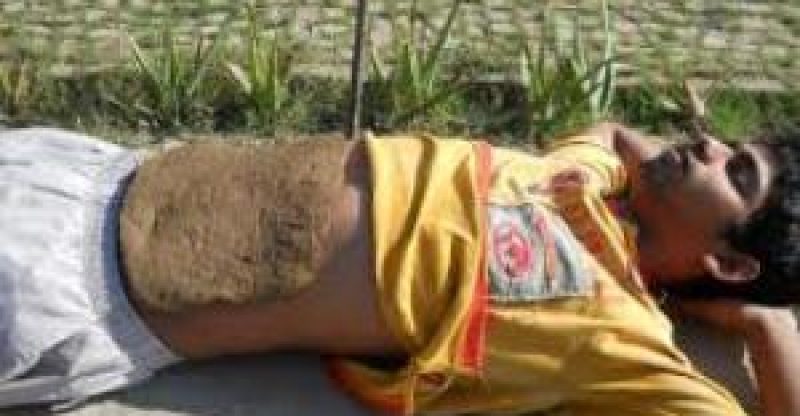 Naturopathy Treatment Methods – Kidney Pack, Abdominal Pack, GH Pack