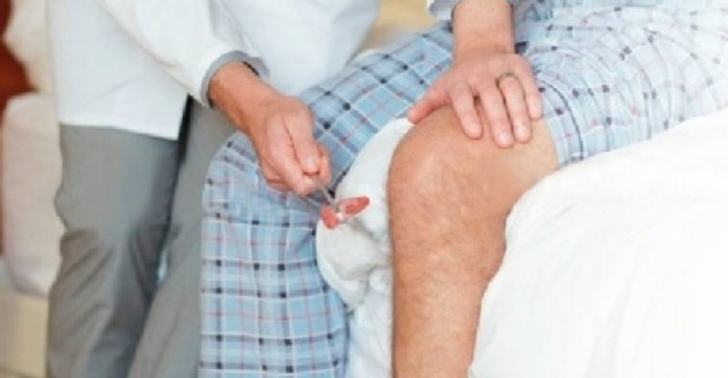 Naturopathy – Arthritis, Rheumatism – Causes, Symptoms