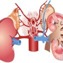 Homeopathic Medicines for Permanent Kidney Failure