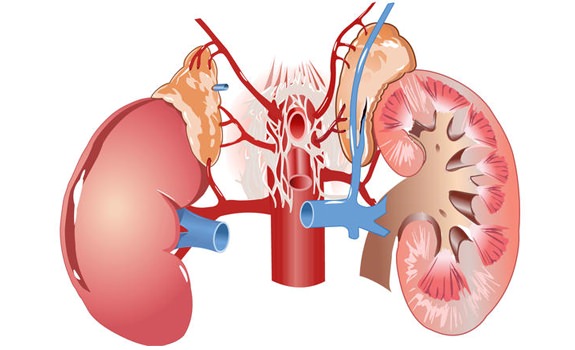 Homeopathic Medicines for Permanent Kidney Failure 1