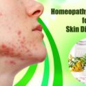 10 Amazing Homeopathic Medicine for Various Skin Diseases