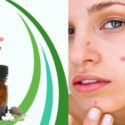6 Amazing Homeopathic Medicines To Remove Scars