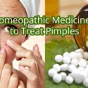 12 Effective Homeopathic Medicines For Cure Pimples