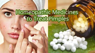12 Effective Homeopathic Medicines For Cure Pimples