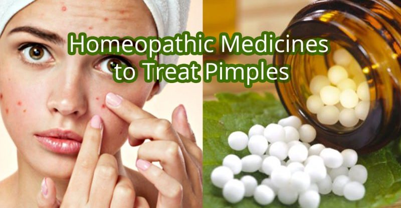 12 Effective Homeopathic Medicines For Cure Pimples