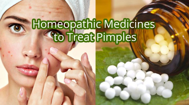 homeopathic medicines to cure pimples